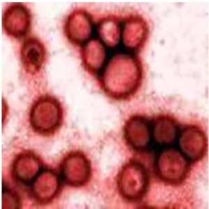 Bệnh cúm lợn và mối nguy gây đại dịch cho cộng đồng