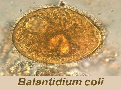 Cách phòng và trị tiêu chảy phân xám ở heo do Balantidium coli gây ra